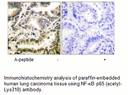 Product image for NF-&kappa;B p65 (Acetyl-Lys310) Antibody