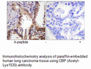 Product image for CBP (Acetyl-Lys1535) Antibody