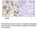 Product image for NF-&kappa;B p65 (Ab-310) Antibody