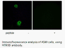 Product image for HTR1B Antibody