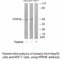 Product image for HTR1B Antibody
