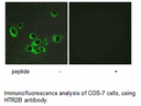 Product image for HTR2B Antibody