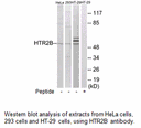 Product image for HTR2B Antibody