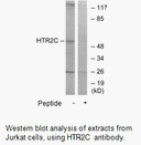 Product image for HTR2C Antibody