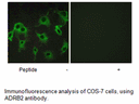 Product image for ADRB2 Antibody