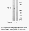 Product image for FZD10 Antibody