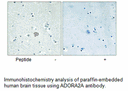 Product image for ADORA2A Antibody