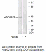 Product image for ADORA2A Antibody