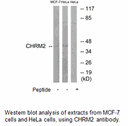 Product image for CHRM2 Antibody