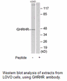 Product image for GHRHR Antibody