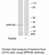 Product image for GPR146 Antibody