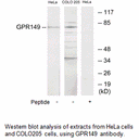 Product image for GPR149 Antibody