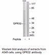 Product image for GPR32 Antibody