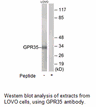 Product image for GPR35 Antibody