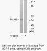 Product image for MC4R Antibody