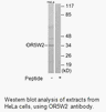 Product image for OR5W2 Antibody