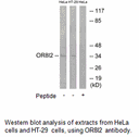 Product image for OR8I2 Antibody