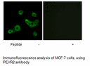 Product image for PEVR2 Antibody
