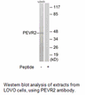 Product image for PEVR2 Antibody