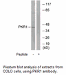 Product image for PKR1 Antibody
