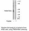 Product image for TMEM185A Antibody
