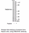 Product image for TMEM145 Antibody