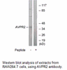 Product image for AVPR2 Antibody