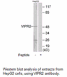 Product image for VIPR2 Antibody