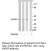 Product image for VN1R3 Antibody