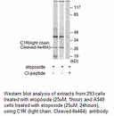 Product image for C1R (light chain,Cleaved-Ile464) Antibody