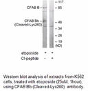Product image for CFAB Bb (Cleaved-Lys260) Antibody