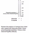 Product image for Dipeptidyl-peptidase 1 (heavy chain,Cleaved-Arg394) Antibody