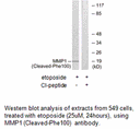 Product image for MMP1 (Cleaved-Phe100) Antibody