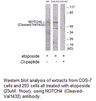 Product image for NOTCH4 (Cleaved-Val1432) Antibody