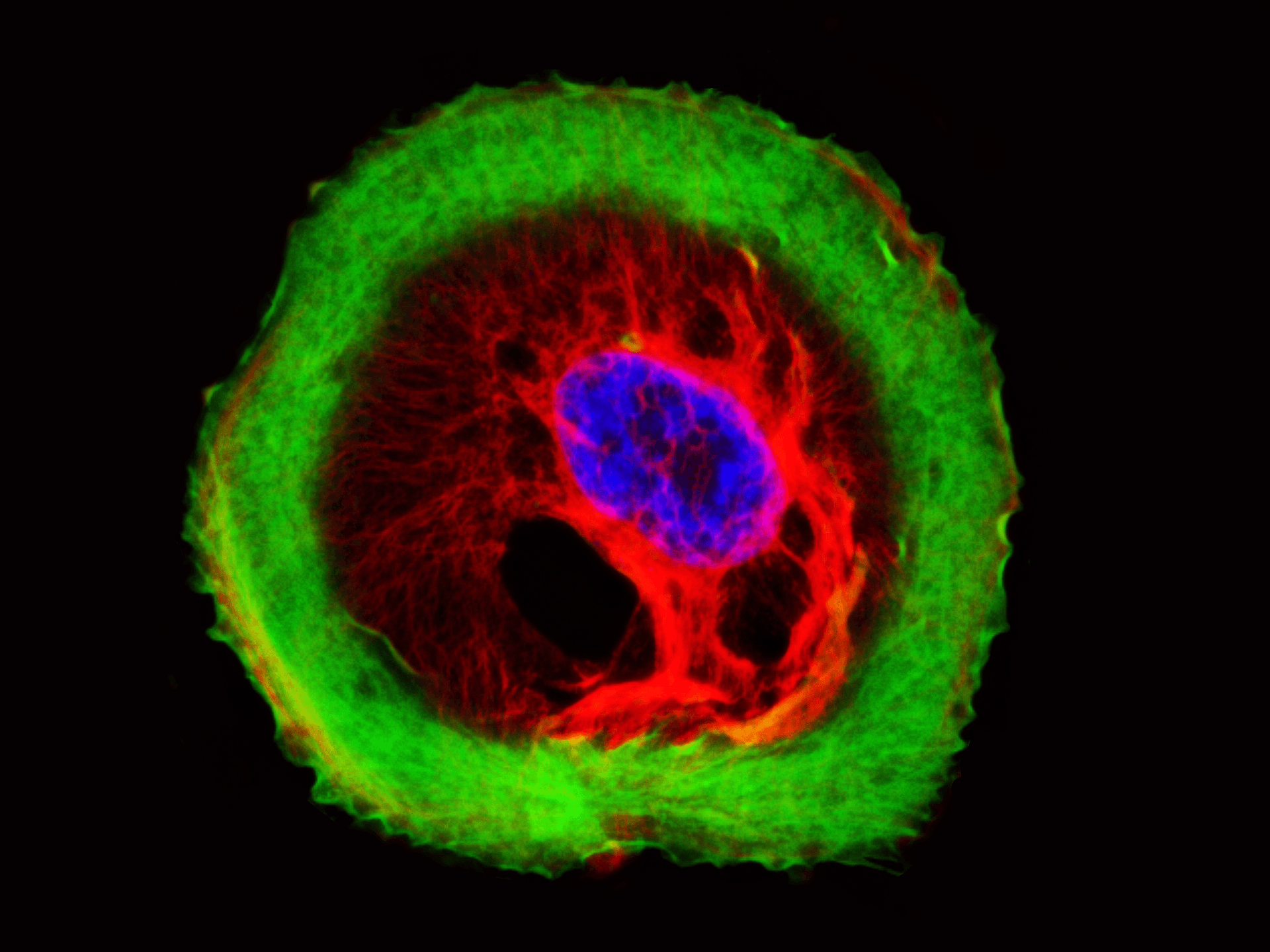 Actin and Tubulin