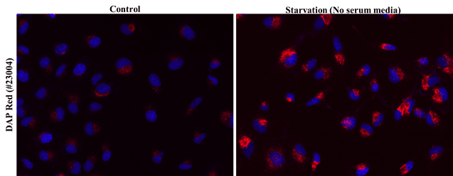 HeLa cells were stained with DAP Red in complete media, followed by serum starvation to induce autophagy. Cells were then counter-stained for nuclear staining using Hoechst 33342 (#22657).