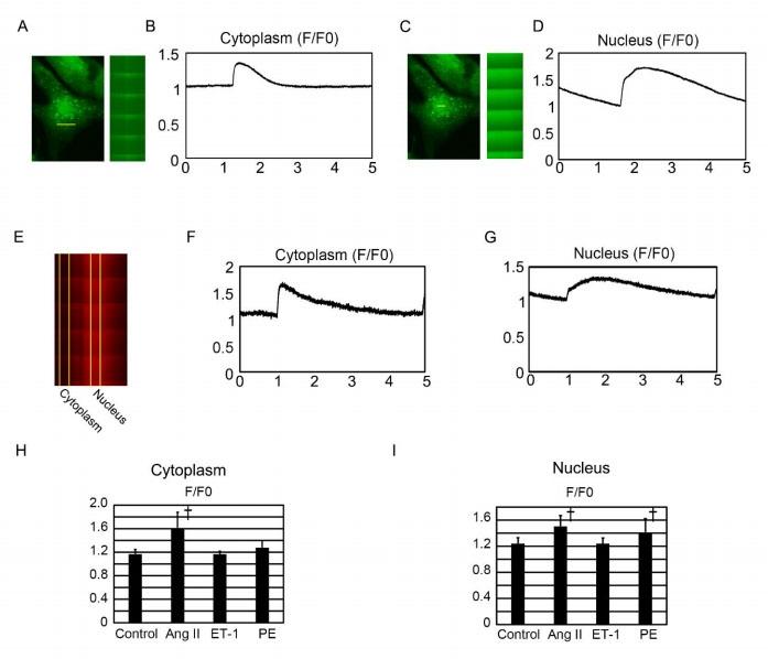 Nuclear calcium transients in neonatal rat ventricular cardiomyocytes (NRVCs) exposed to hypertrophic stimuli. A. Original recording of only cytoplasmic Ca<sup>2+</sup> transients in NRVC with fluo-4. B. Line scan imaging of only cytoplasmic Ca<sup>2+</sup> transients in cardiomyocytes with fluo-4. C. Original recording of only nucleus Ca<sup>2+</sup> transients in cardiomyocytes with fluo-4. D. Line scan imaging of cytoplasmic Ca<sup>2+</sup> transients in cardiomyocytes with fluo-4. E. Original recording of cytoplasmic and nucleus Ca<sup>2+</sup> transients in NRVC with a different Ca indicator, Rhod-4. F. Line scan imaging of only cytoplasmic Ca<sup>2+</sup> transients in cardiomyocytes with Rhod-4. G. Line scan imaging of nuclear Ca<sup>2+</sup> transients in cardiomyocytes with Rhod-4. H. Average values of the effects of hypertrophic stimuli on time to F/F0 in the cytoplasm of NRVCs exposed to vehicle (control; n = 19), Ang II (n = 42), ET-1 (n = 21), or PE (n = 29). I. Average values of the effects by hypertrophic stimuli on time to F/F0 in the nucleus of NRVCs exposed to vehicle (control; n = 19), Ang II (n = 42), ET-1 (n = 21), or PE (n = 29). *P &lt; 0.05 compared to the control. **P &lt; 0.01 compared to the control. &dagger;P &lt; 0.001 compared to the control.&nbsp;Source: <strong>Emerin plays a crucial role in nuclear invagination and in the nuclear calcium transient</strong> by Shimojima et al., <em>Scientific Reports,</em> March 2017.