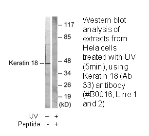 Product image for Keratin 18 (Ab-33) Antibody