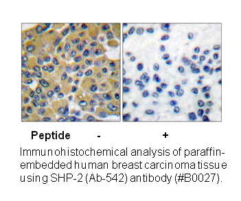 Product image for SHP-2 (Ab-542) Antibody