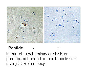 Product image for CCR5 (Ab-336) Antibody
