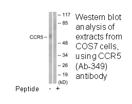 Product image for CCR5 (Ab-349) Antibody