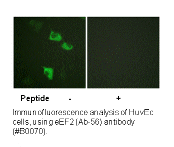 Product image for eEF2 (Ab-56) Antibody