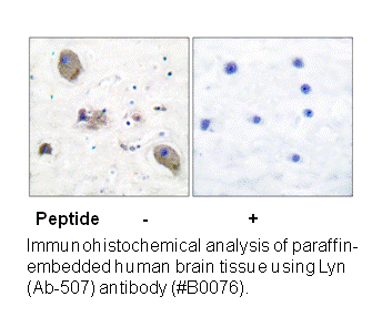 Product image for Lyn (Ab-507) Antibody