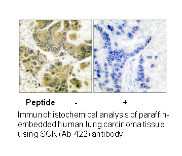 Product image for SGK (Ab-422) Antibody