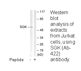 Product image for SGK (Ab-422) Antibody