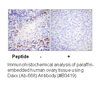 Product image for Daxx (Ab-668) Antibody