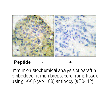 Product image for IKK-&beta; (Ab-188) Antibody