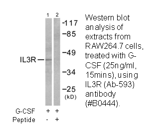 Product image for IL-3R&beta; (Ab-593) Antibody