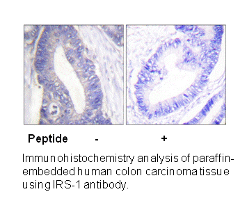 Product image for IRS-1 (Ab-1101) Antibody