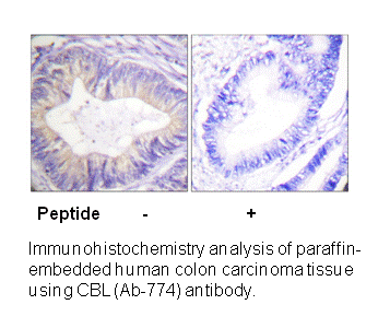 Product image for CBL (Ab-774) Antibody